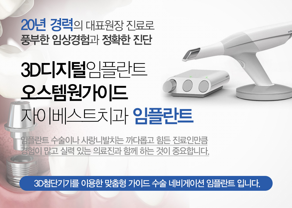 3D디지털임플란트  오스템원가이드. 자이베스트치과 임플란트